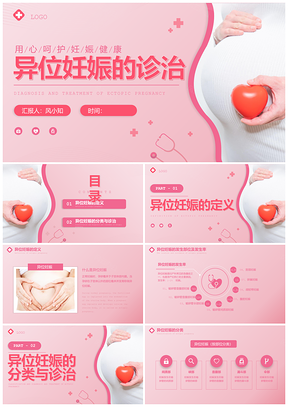 粉色实拍风异位妊娠诊治孕妇医疗培训PPT模板
