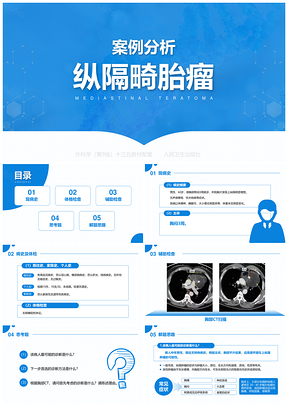 蓝色外科学第9版第二十八章原发性纵隔肿瘤案例分析纵隔畸胎瘤PPT模板